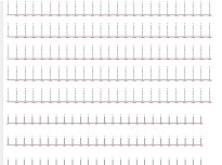 ANETİ çizgili yazı çalışma sayfası